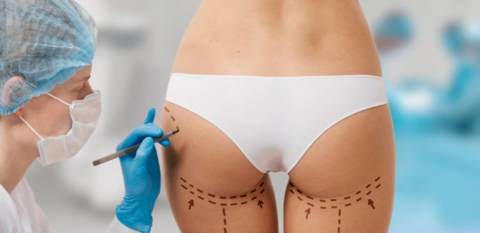 brazilian buttock lift turkey