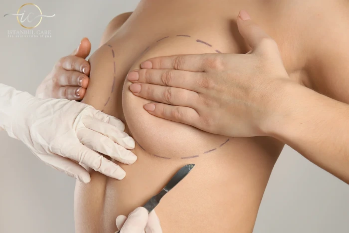 breast lift in turkey