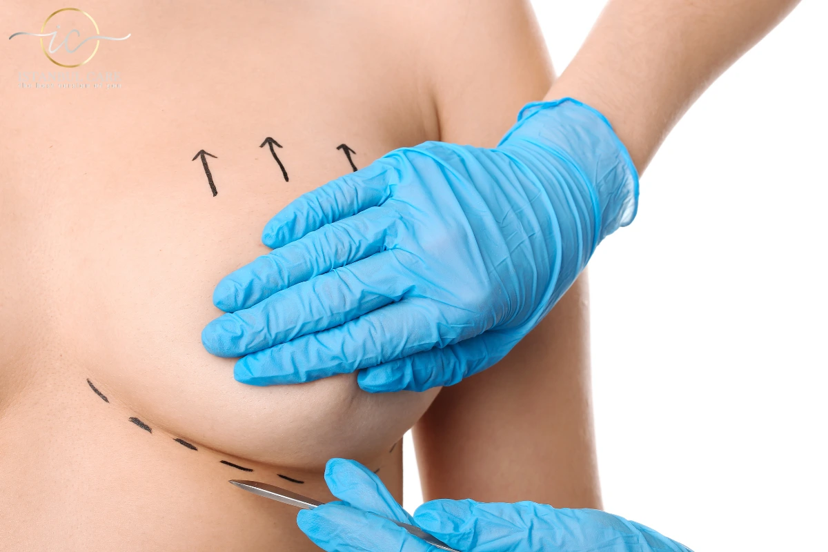 breast-lift-istanbul Breast. Lift Istanbul