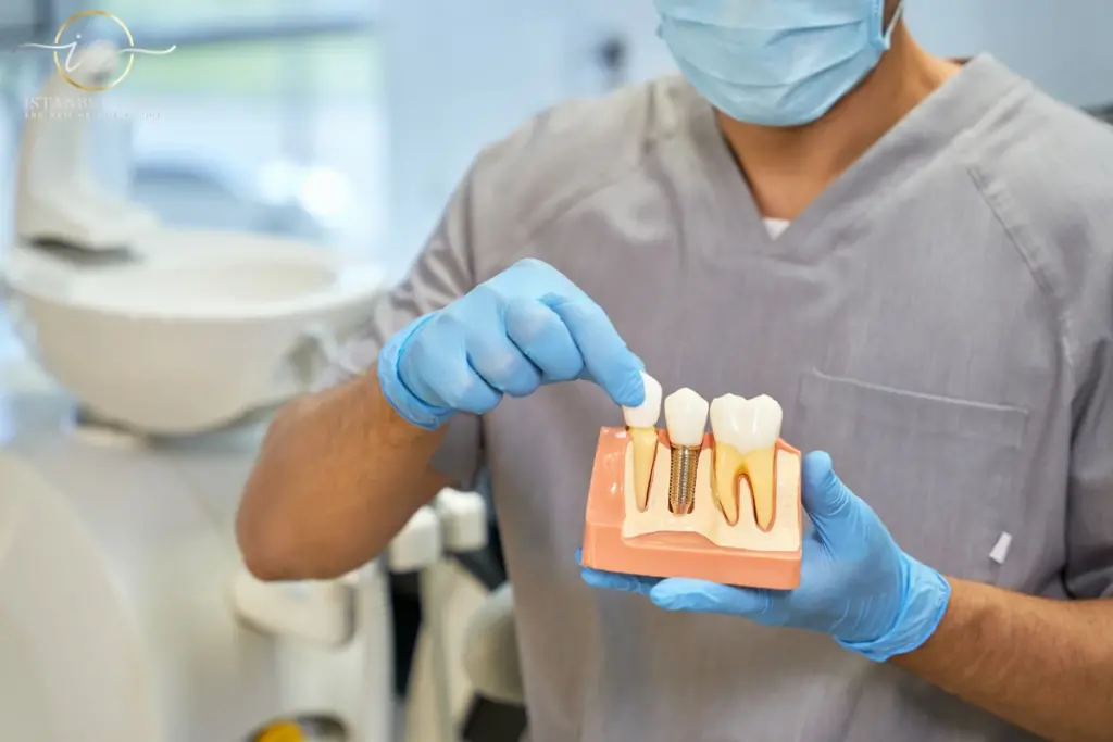 Dental Implant