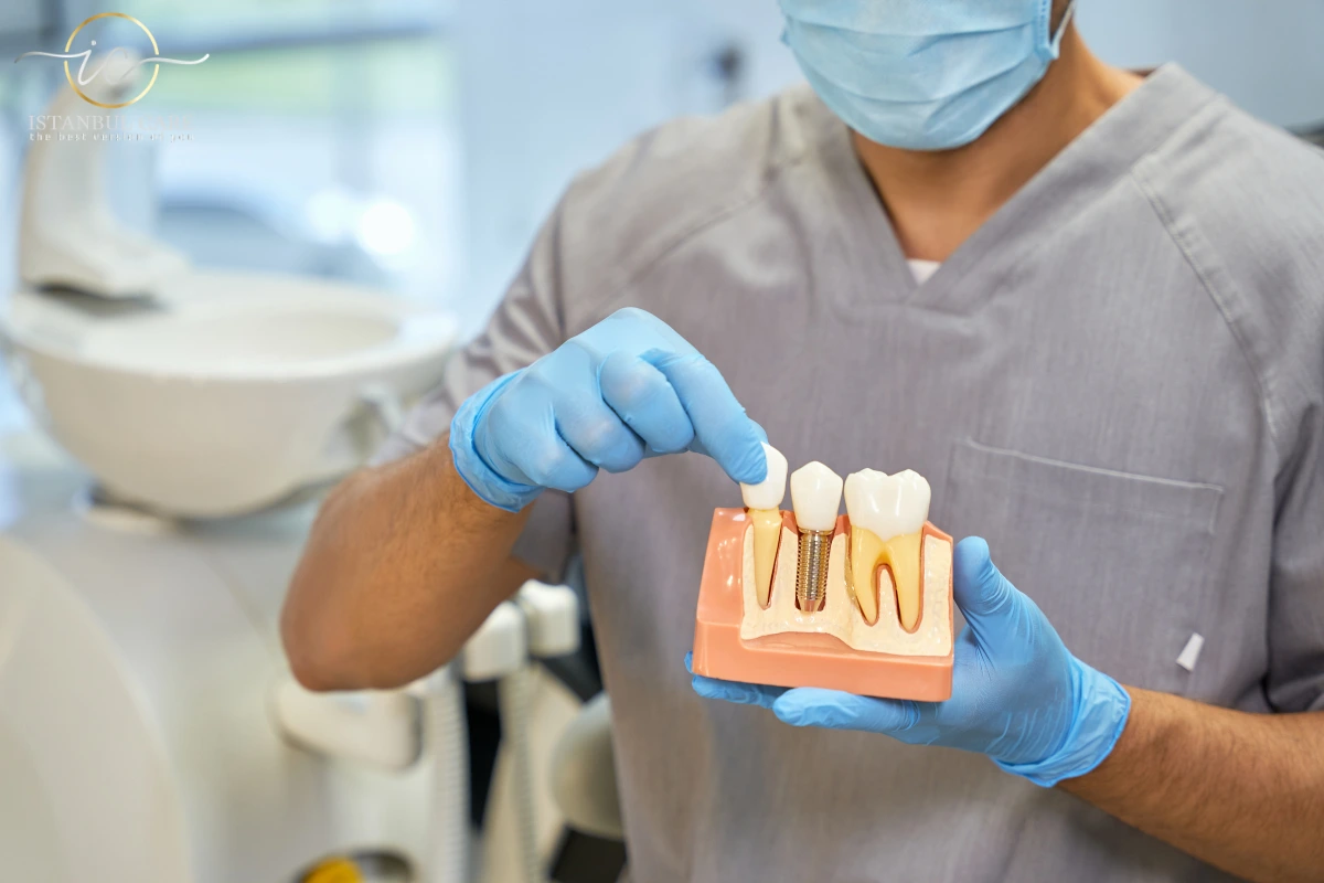 dental-implant Dental Implant