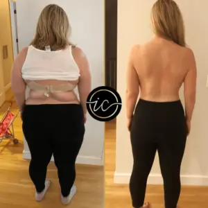 gastric balloon turkey istanbul before after