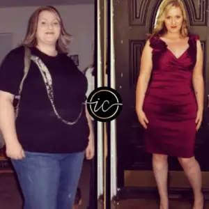 gastric bypass surgery turkey price