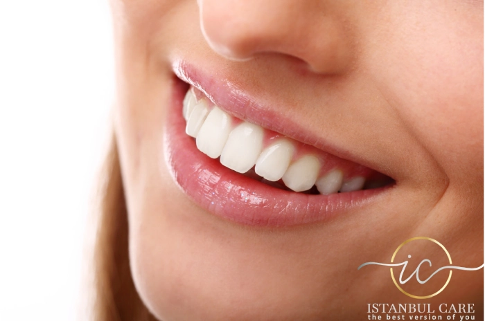 Hollywood Smile in Albania